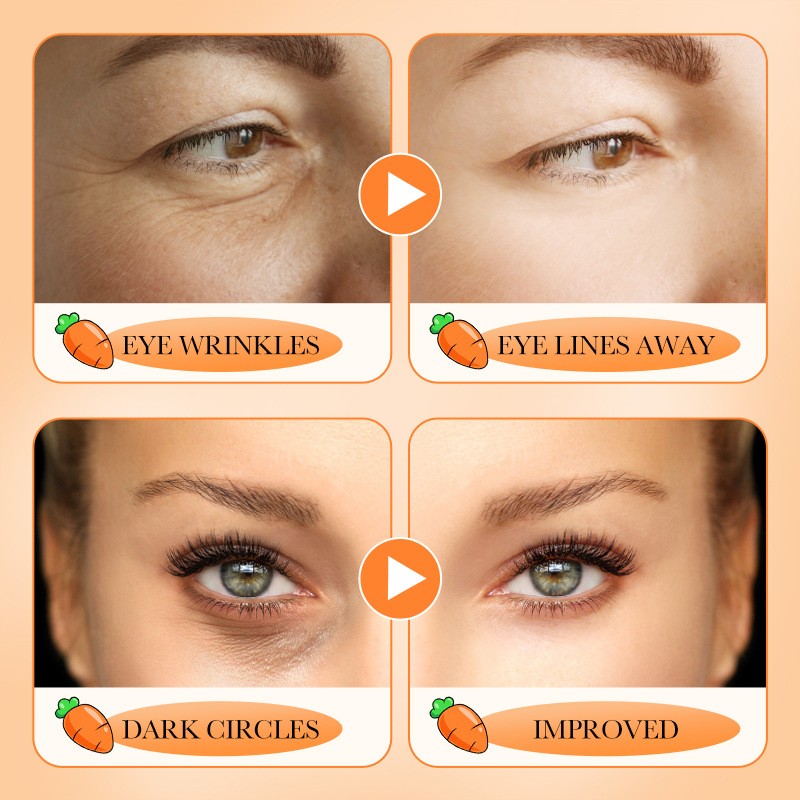 20g Moisturizes and Improves Dark Circles Eye Lines and Eye Bags Carrot Eye Cream
