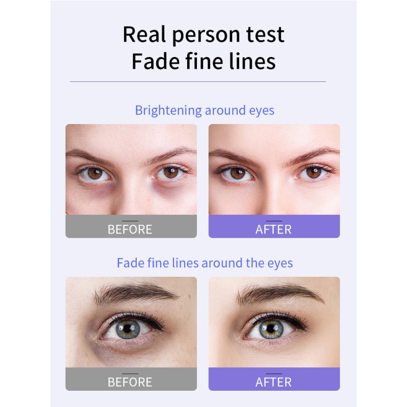 Whitening Anti-Wrinkle Moisturizing Eye Cream with Roller Massage for Dark Circles Removal