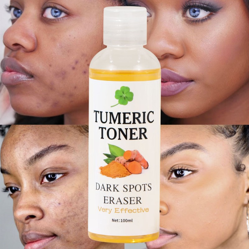 Dark Spots Eraser Facial Toner for Adults Female Travel Size with Turmeric Spots and Arbutin Ginger Extract Black Spray