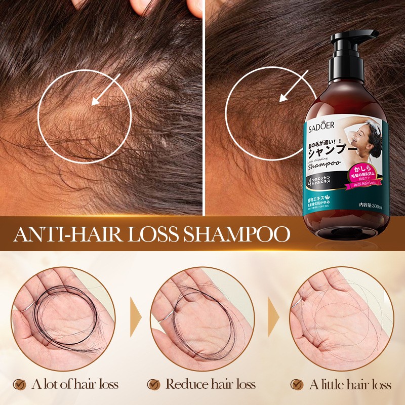 SADOER Shampoo, Cleansing, Anti-dandruff Foam and Anti-hair Loss Shampoo