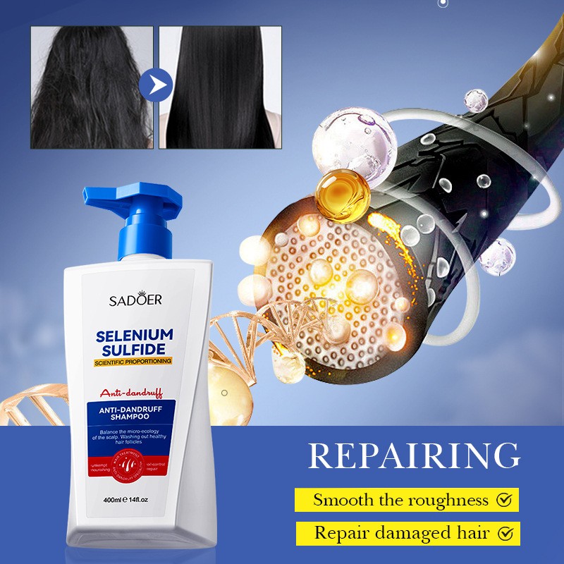 Anti-dandruff Shampoo, Selenium Disulfide Cleaning Shampoo SADOER Hair Shampoo