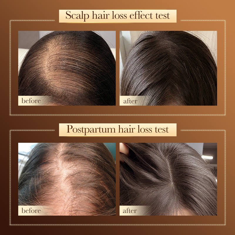 Hydrating Shampoo, Smooth, Cleansing and Anti-hair Loss Shampoo SADOER