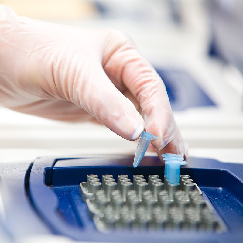 Sterile Latex Gloves Factory - OEM Long Gynecologic