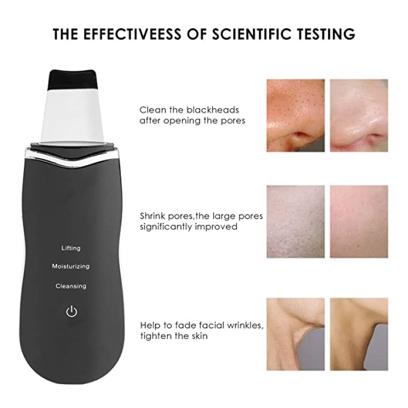 Electronic Skin Scrubber Facial Cleaner Shovel Ultrasonic Facial Skin Scrubber Peeling Blackhead Remover Facial Massager
