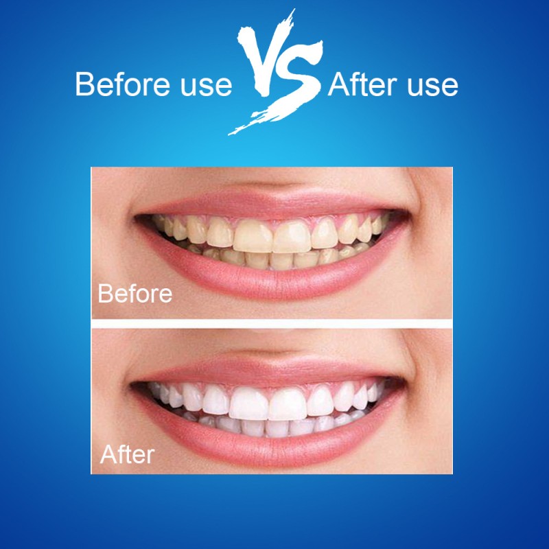 Professional Teeth Whitening Strips  Oral Hygiene at Home Teeth Whitener Dental Strips 7pairs Whitening Teeth Strips