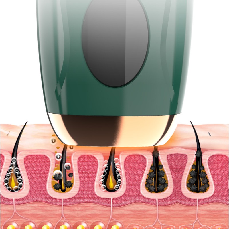 Best Hair Removal Device 5 Gears Flashes Light Hair Removal Device  LCD Display Hair Removal System for Legs