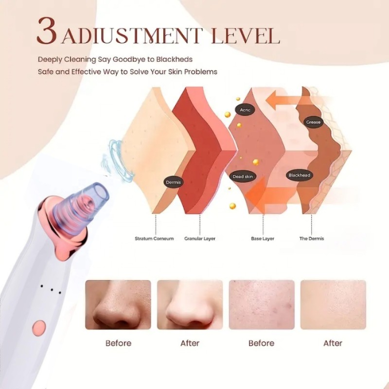 Rechargeable 5 in 1 Facial Pore Deep Cleaning Electric Suction Blackheads Acne Pore Cleaner  Nose Blackhead Remover Vacuum