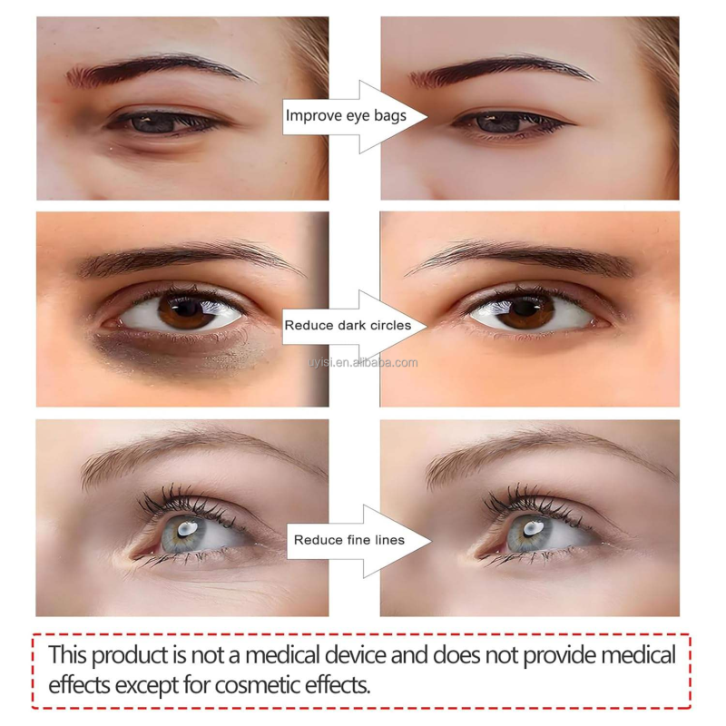 Uyisi 3D Eye Bag Device Remover Quickly Remove Dark Circles Wrinkles Relax Eye Massager with 2 Modes Relieve Eyes Bags