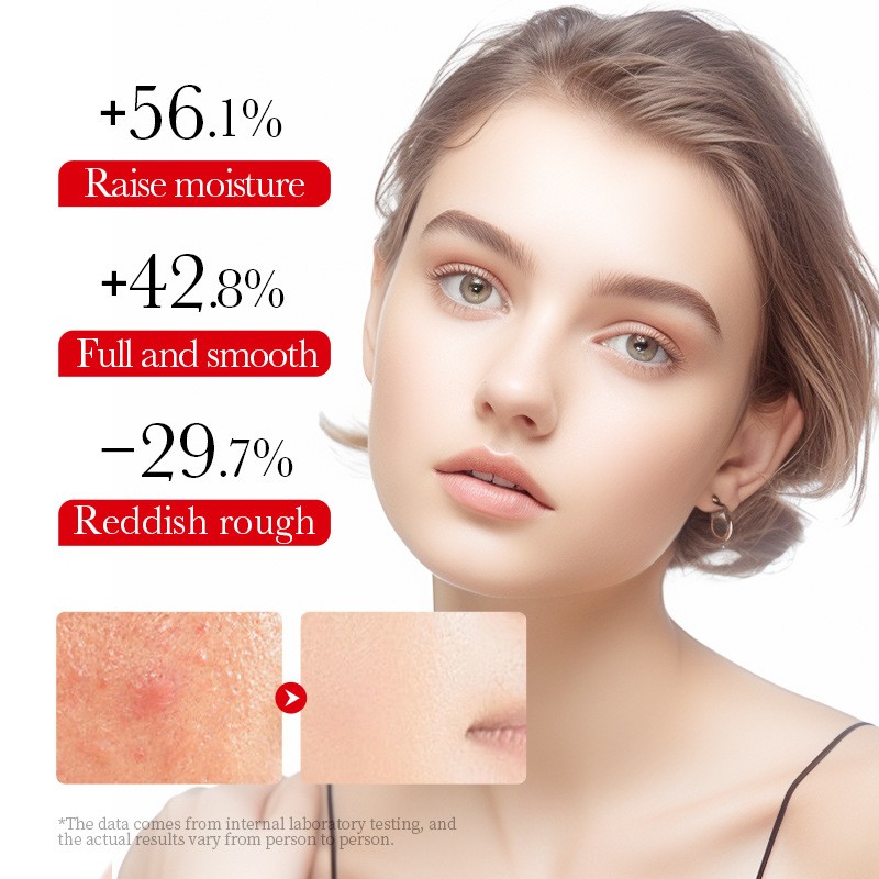 Turmeric Cream - OEM Deep Repair Moisturizer