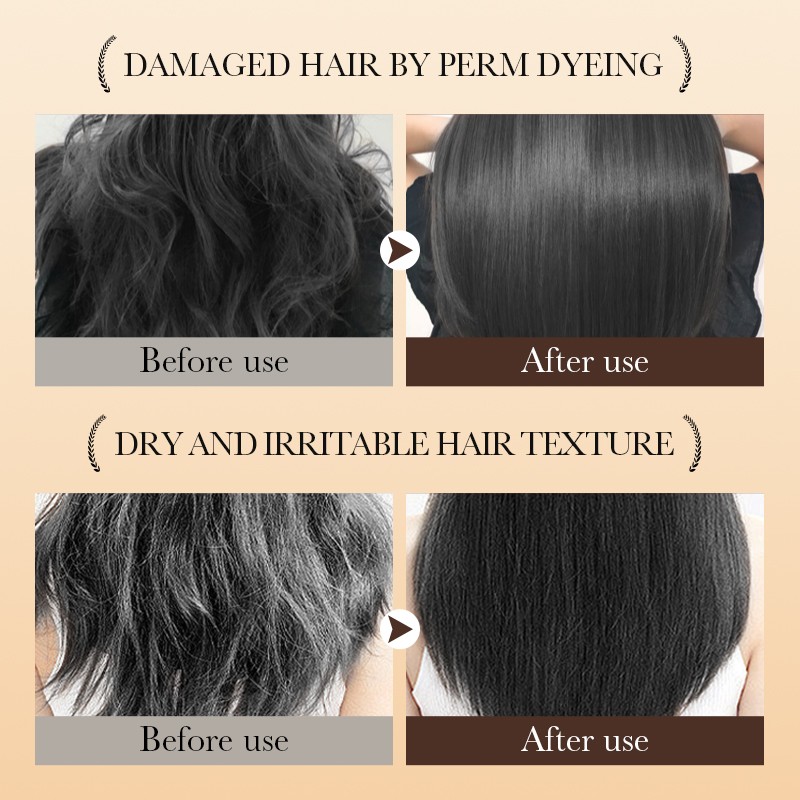 Shampoo - OEM Rose Hip Anti-Dandruff