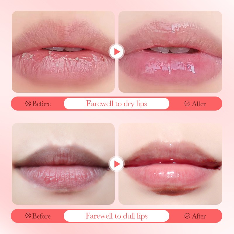 Lip Balm - OEM Fruit Plant Moisturize Cream