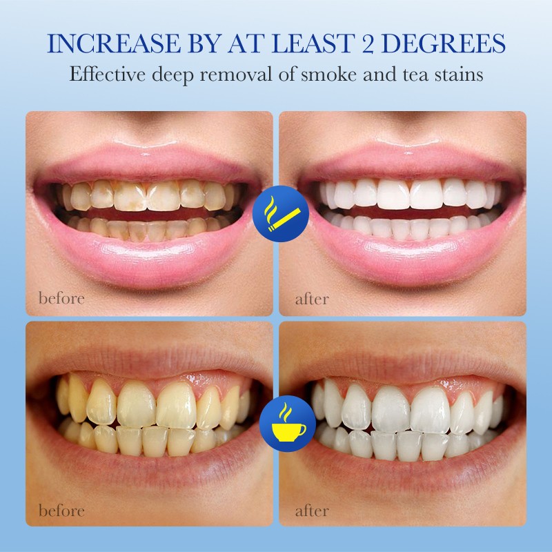 Mouthwash - OEM Teeth Whitening Oral Care