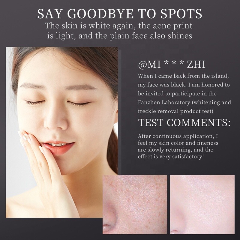 Freckle Removal Set - OEM Brightening Skin Care Box