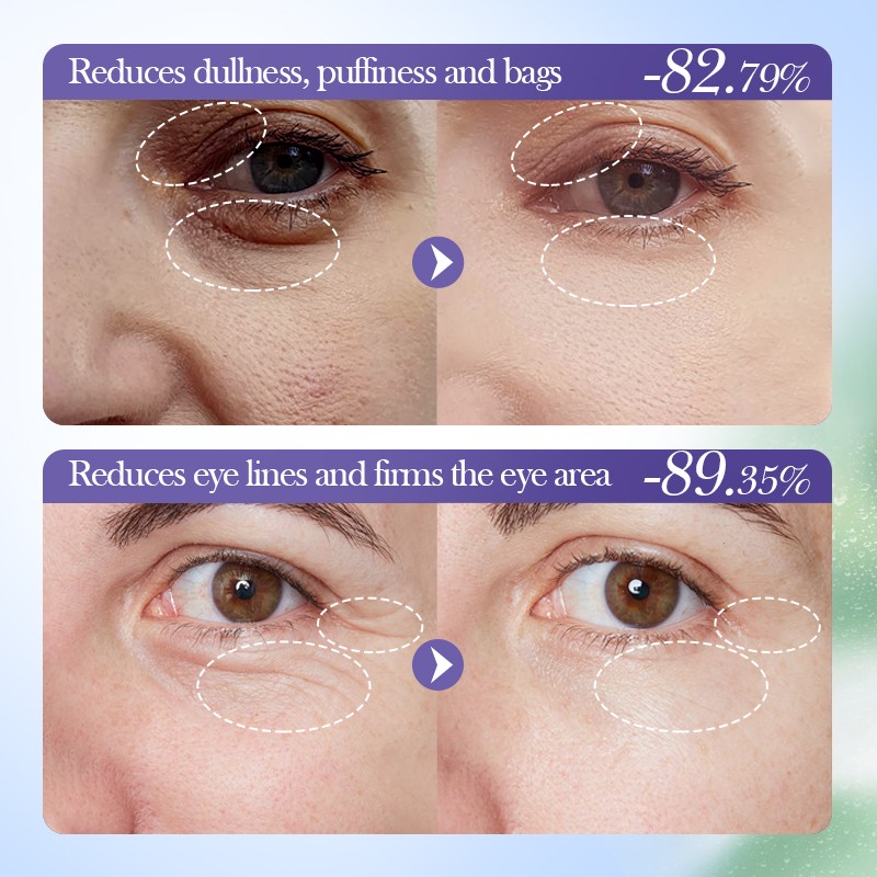 Eye Cream - OEM Nourishing Elastic Formula