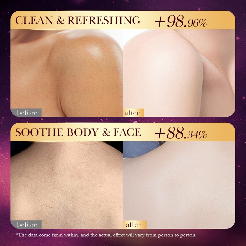 Body Soap - OEM Turmeric Essential Oil