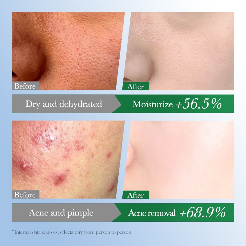 Pore Cleaner Stick - OEM Whitening Mud Mask