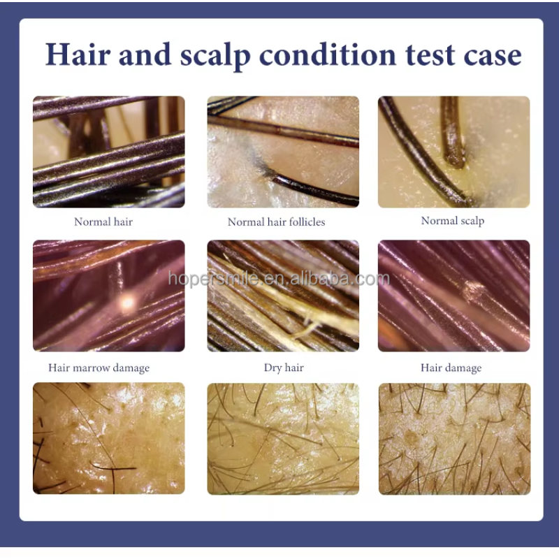 Scalp Scanner - OEM 7 Inch HD Detector Factory