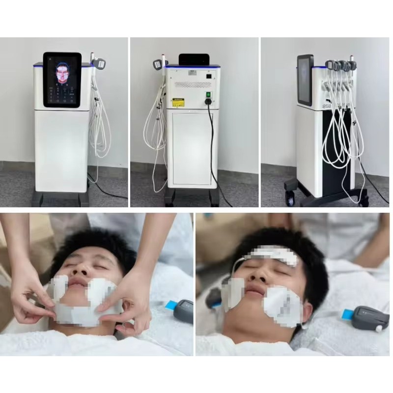Facial Rejuvenation - OEM EM PE Face Device System