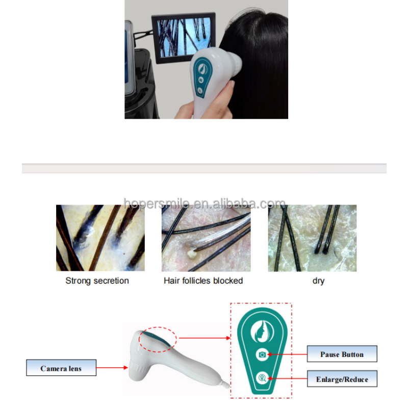 Magnetic Face Massager - OEM Non Invasive EMT Device