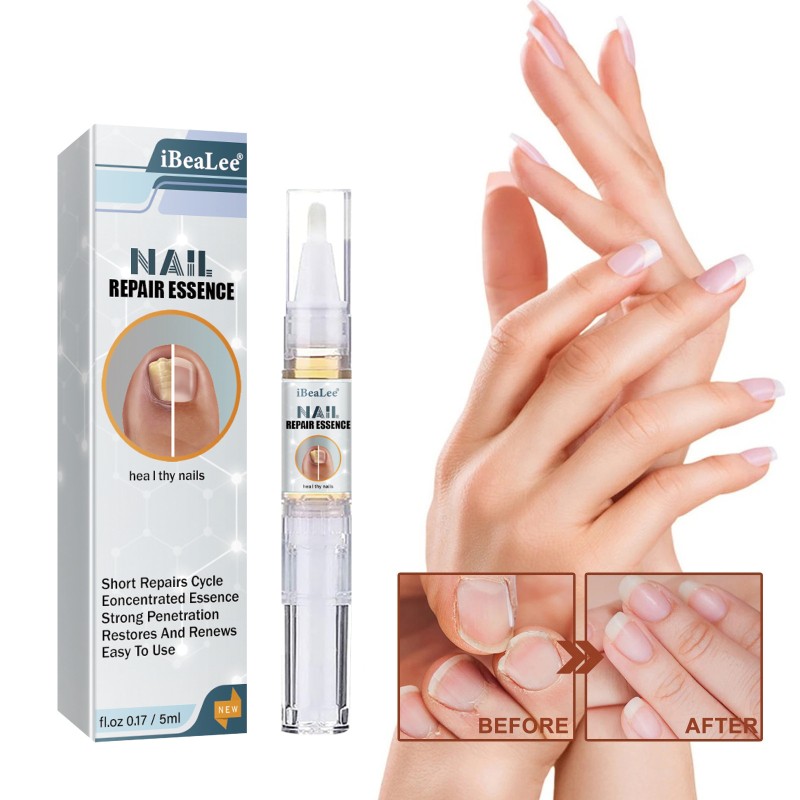 Nail Strengthener Manufacturer - Custom Hand Foot Cracked Nail Care