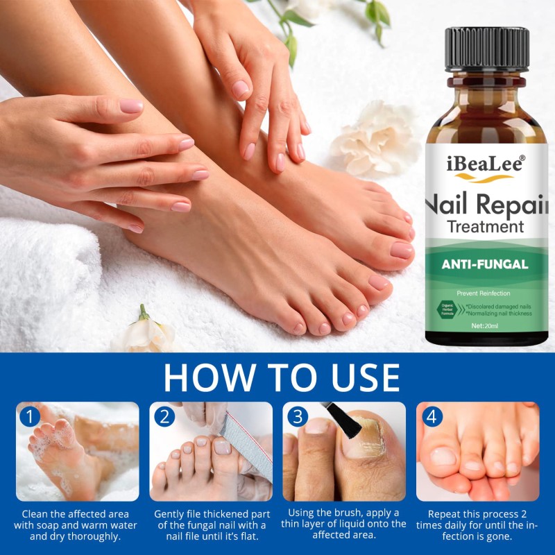 Nail Fungus Treatment Supplier - Bulk Restore Renews Kills Fungus