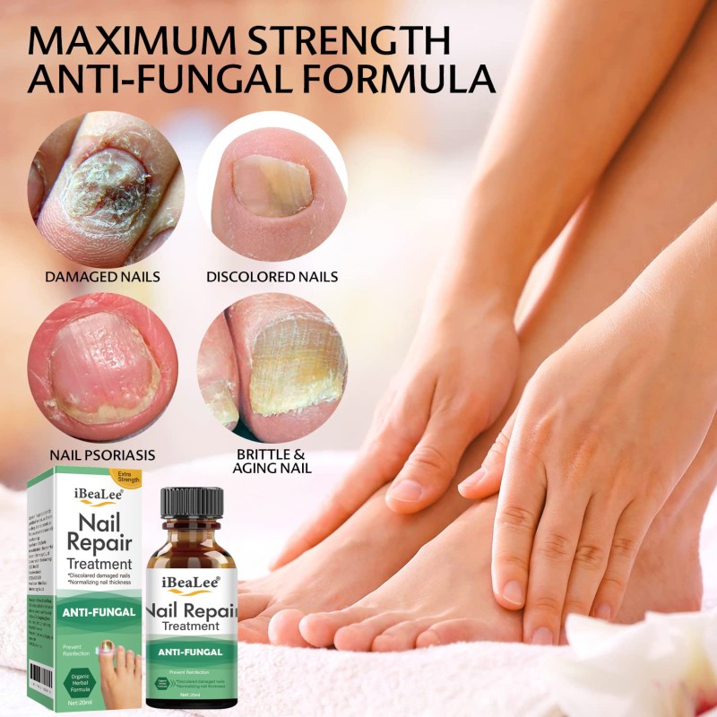 Nail Fungus Treatment Supplier - Bulk Restore Renews Kills Fungus