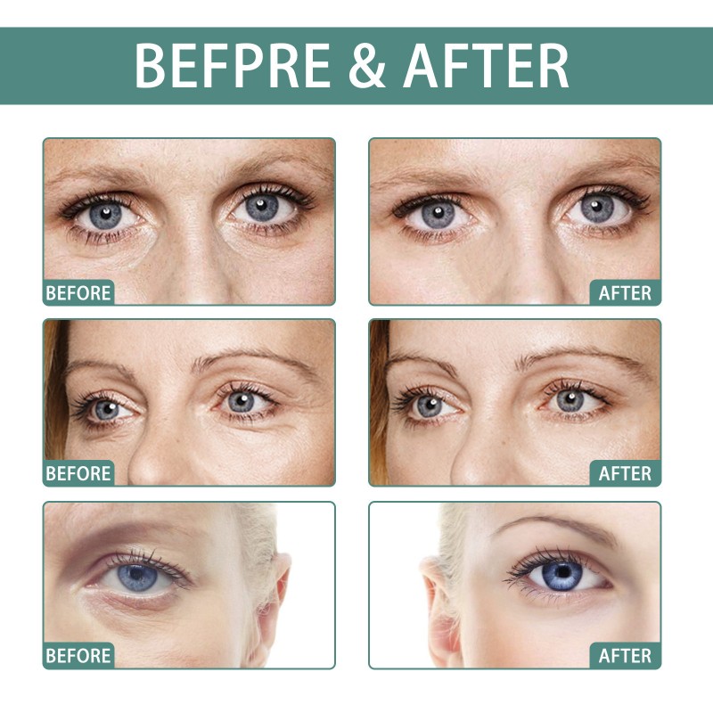 Foot Cream Factory - OEM Urea Cracked Feet Exfoliation Care Stick