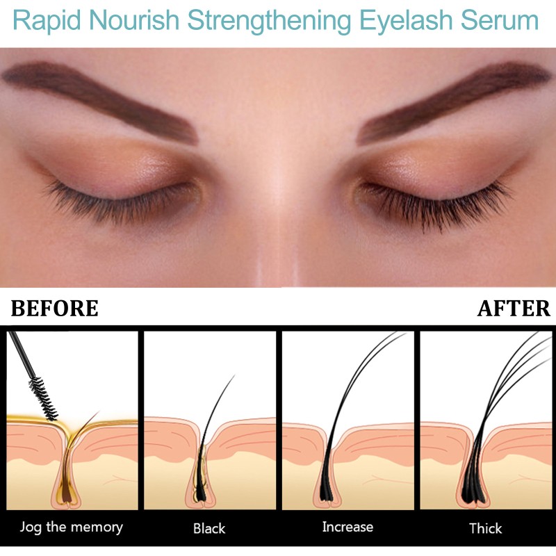 Eyelash Growth Liquid Factory - OEM Rapid Growth Curl Lengthen Serum