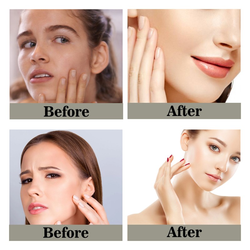 Pain Relief Gel Supplier - Bulk Soothing Massage Freckles Improvement