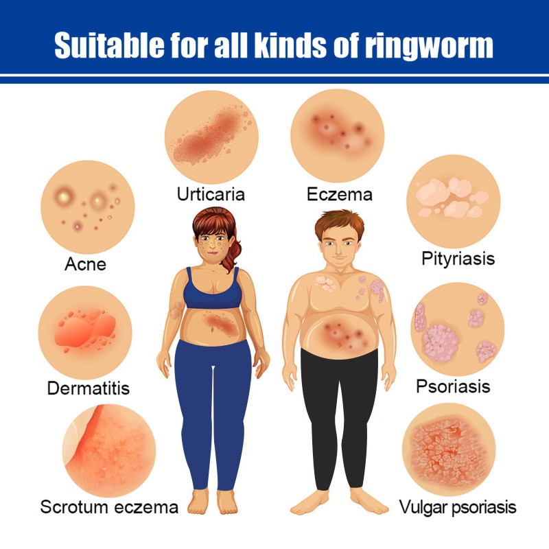 Anti Aging Cream Factory - OEM Bee Venom Retinol 24H Moisture Lock