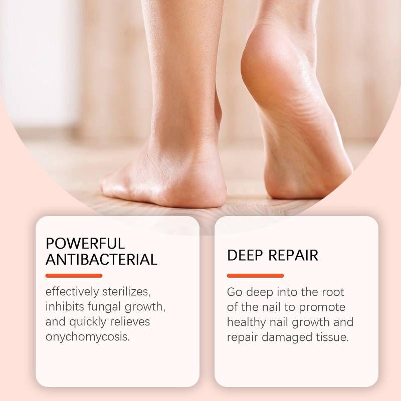Nail Fungus Treatment Manufacturer - Custom Toe Fungal Repair Gel