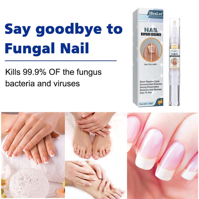 Nail Strengthener Manufacturer - Custom Hand Foot Cracked Nail Care