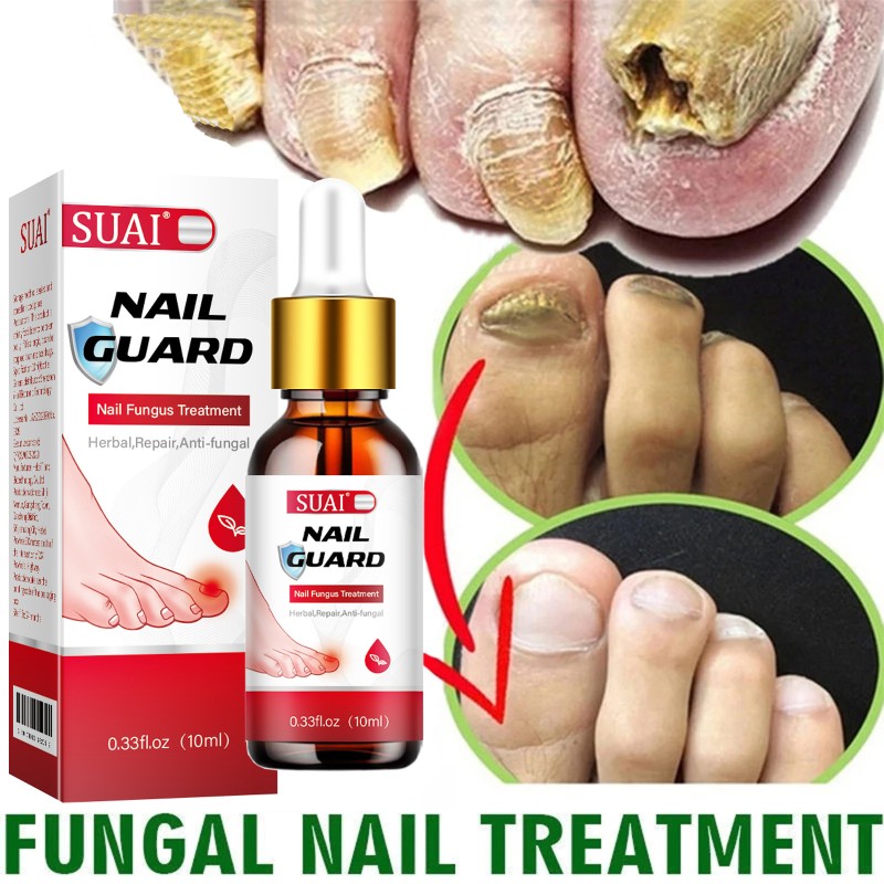 Nail Care Liquid Factory - OEM 20ml Rapid Anti Fungal Hydrating
