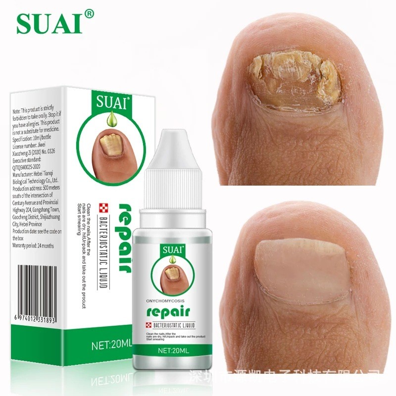 Nail Treatment Device Supplier - Bulk Toenail Fingernail Fungal Care