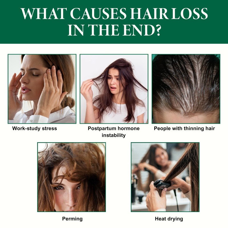 VC Essence Manufacturer - Custom Brightening Spot Removing Lotion