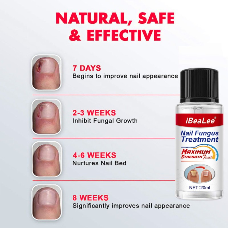 Nail Repair Liquid Manufacturer - Custom Extra Strength Cracked Nail