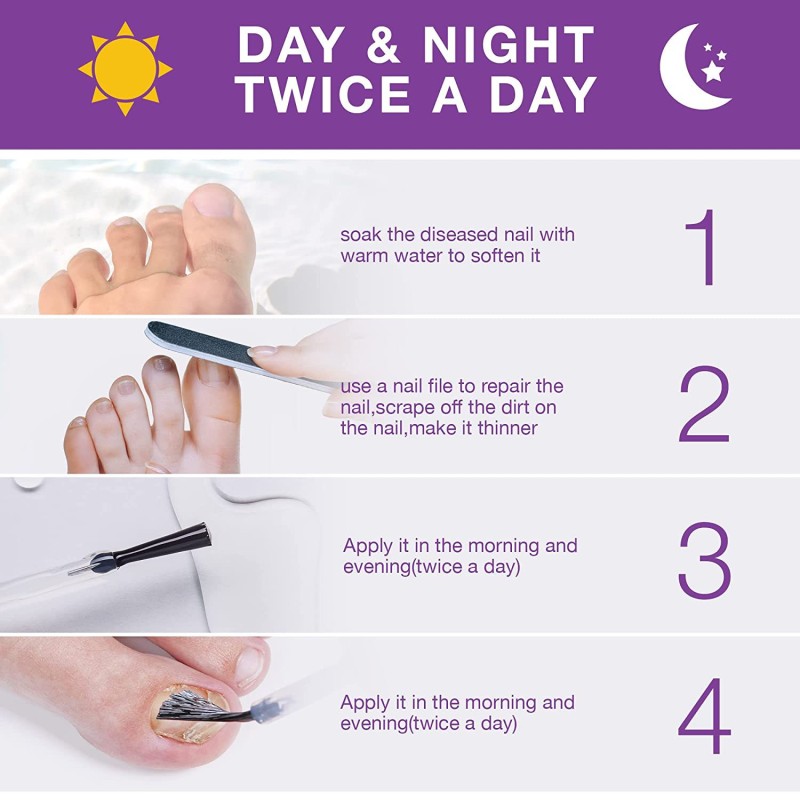 Nail Repair Pen Factory - OEM Toenail Fingernail Fungus Treatment