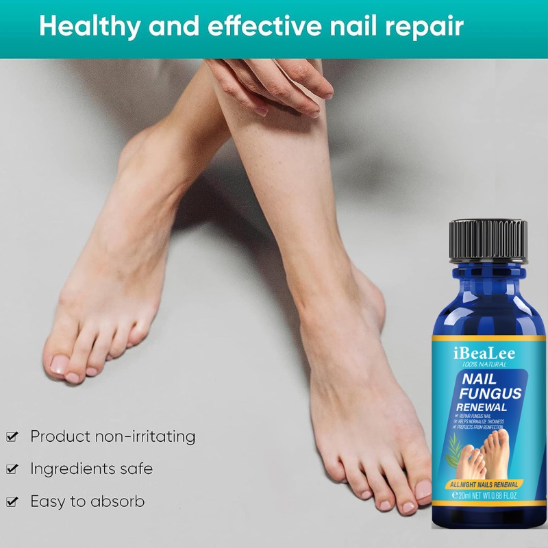 Nail Treatment Serum Supplier - Bulk Herbal Toe Fungus Foot Care