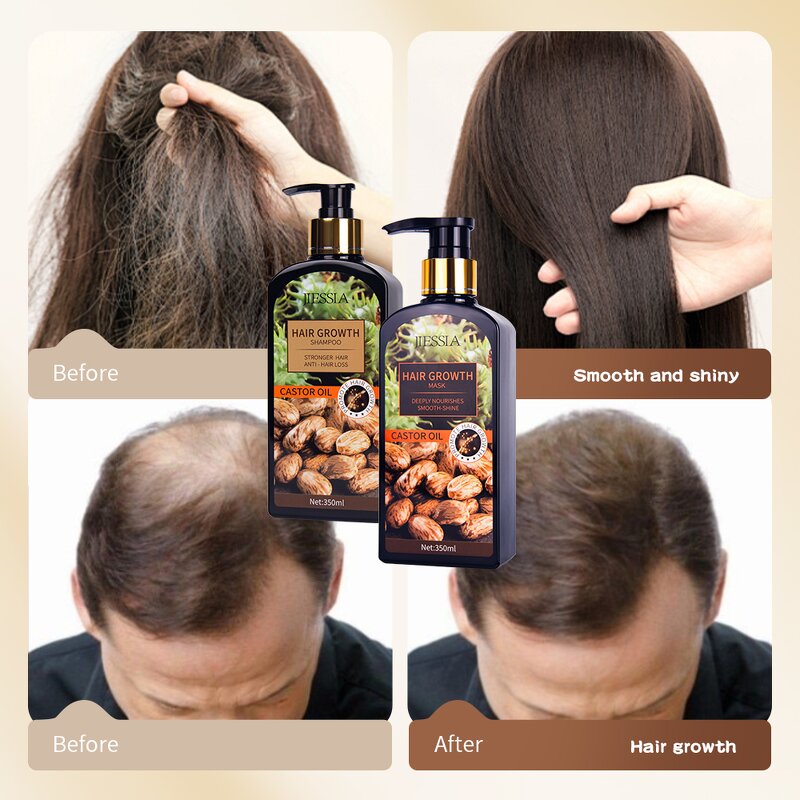 Hair Growth Oil Factory - OEM Private Label