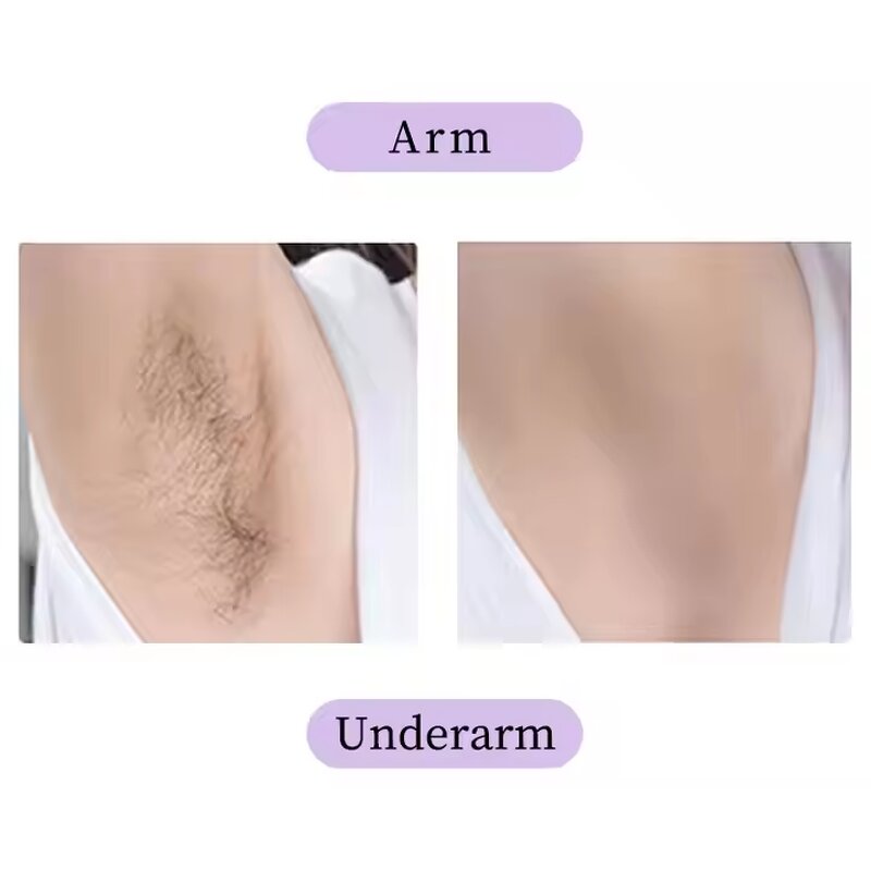 Hair Removal Cream Factory - OEM OEM Manufacturer