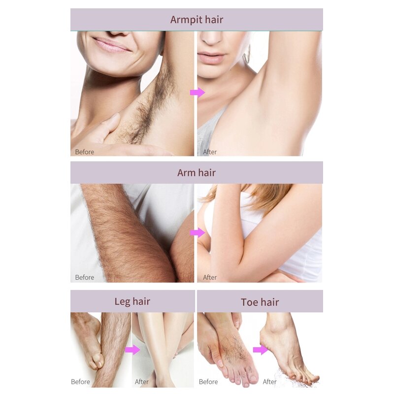 Hair Remover Cream Factory - OEM Quick Easy
