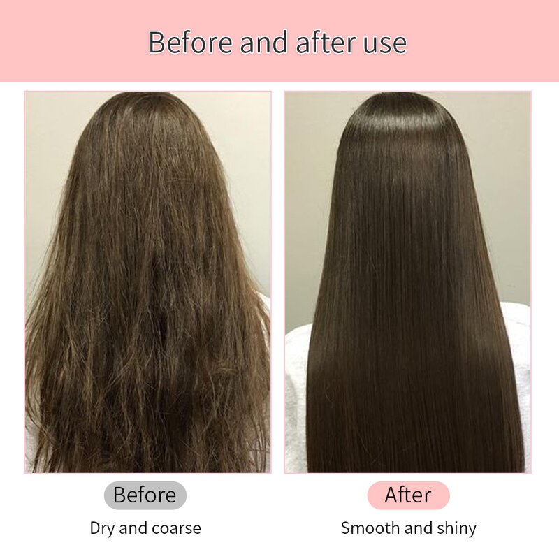 Hair Removal Spray Factory - OEM Hot Selling