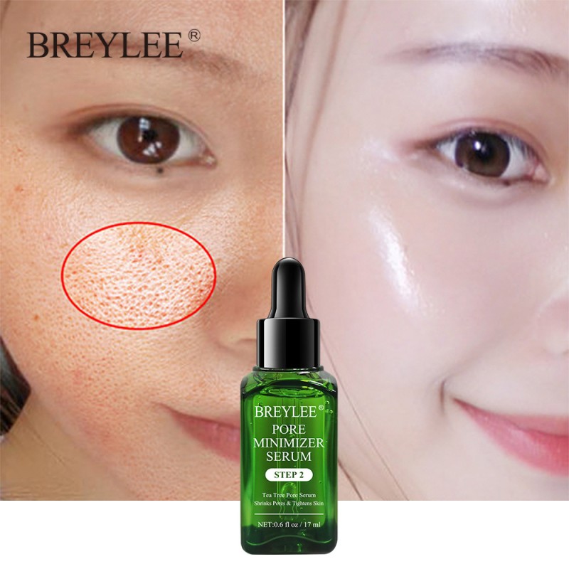Acne Treatment Serum Factory - BREYLEE Natural Facial Essence Scar Removal