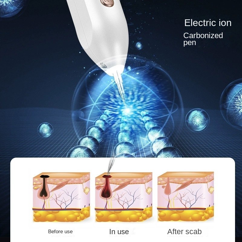 Mole Removal Pen Factory - New Micro Professional Home Use Skin Beauty