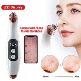 Vacuum Cleaner Manufacturer - OEM Nursing Nose Face Anti-acne Blackhead