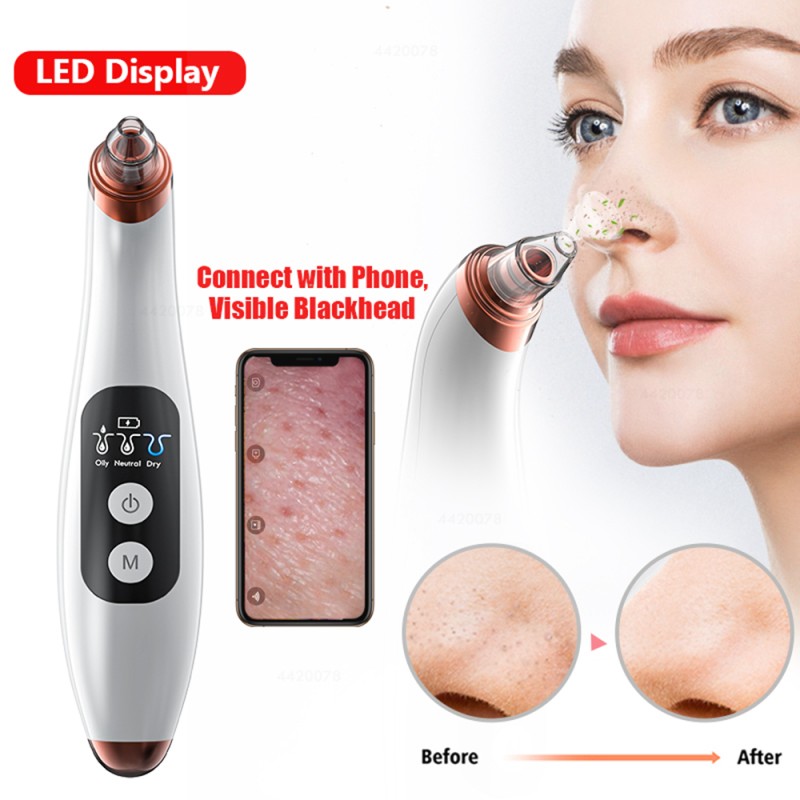 Vacuum Cleaner Manufacturer - OEM Nursing Nose Face Anti-acne Blackhead