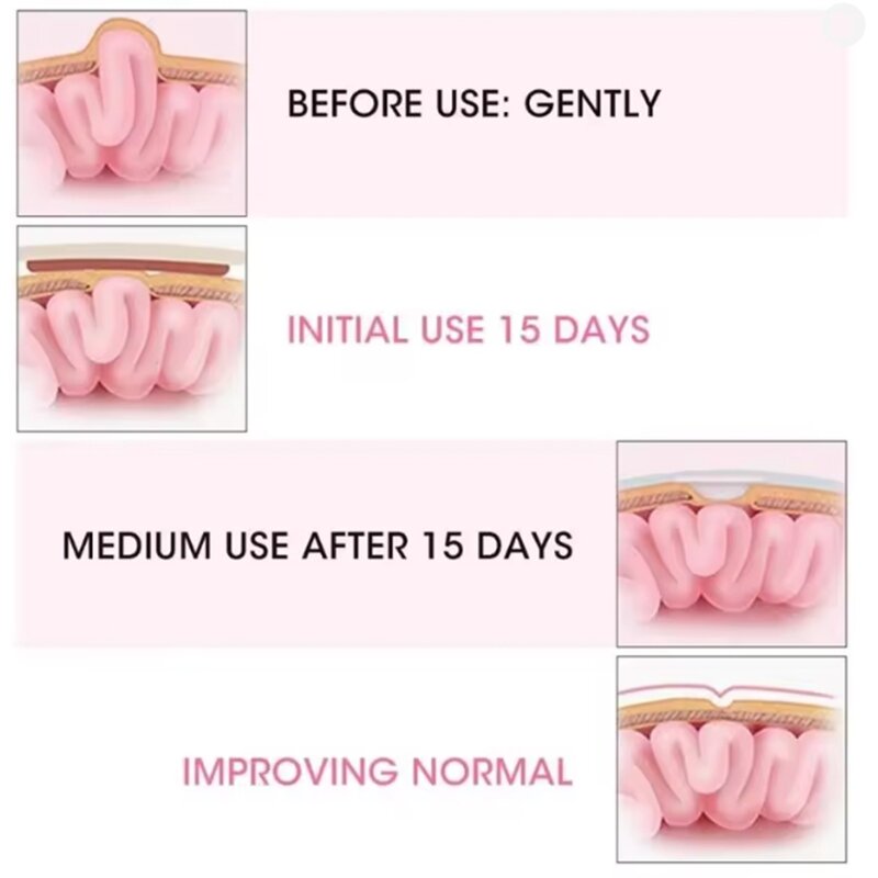 Newborn Hernia Belt Manufacturer - OEM Infant Navel Support Belt