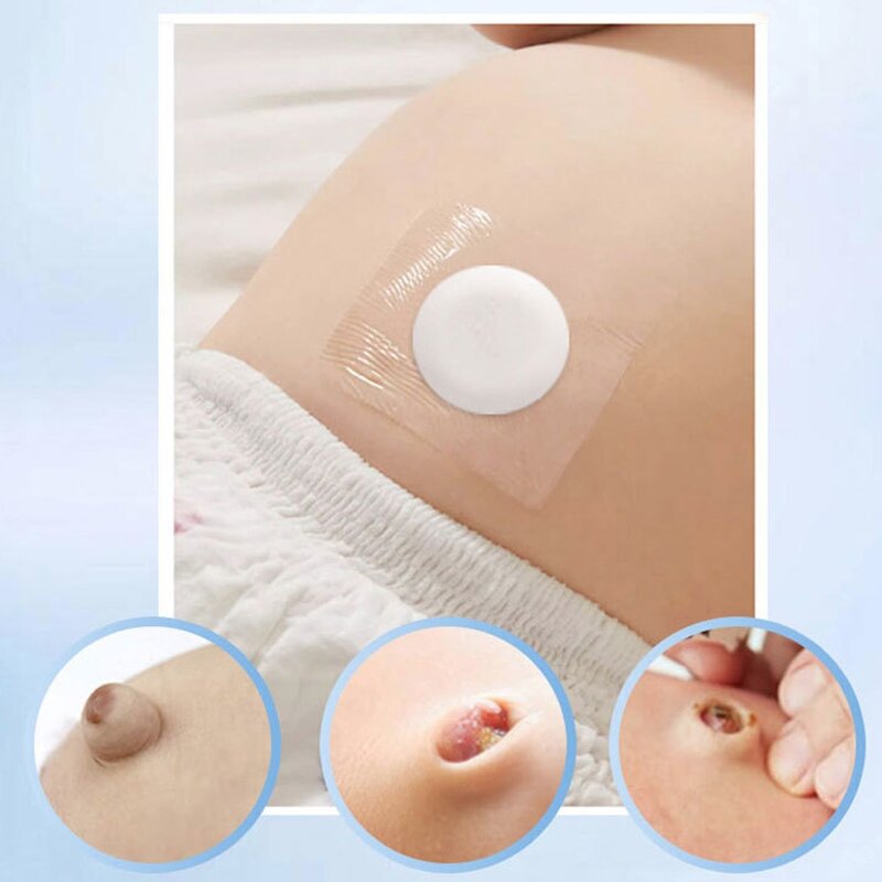 Infant Hernia Patch Manufacturer - OEM Cotton Skin Friendly Patch