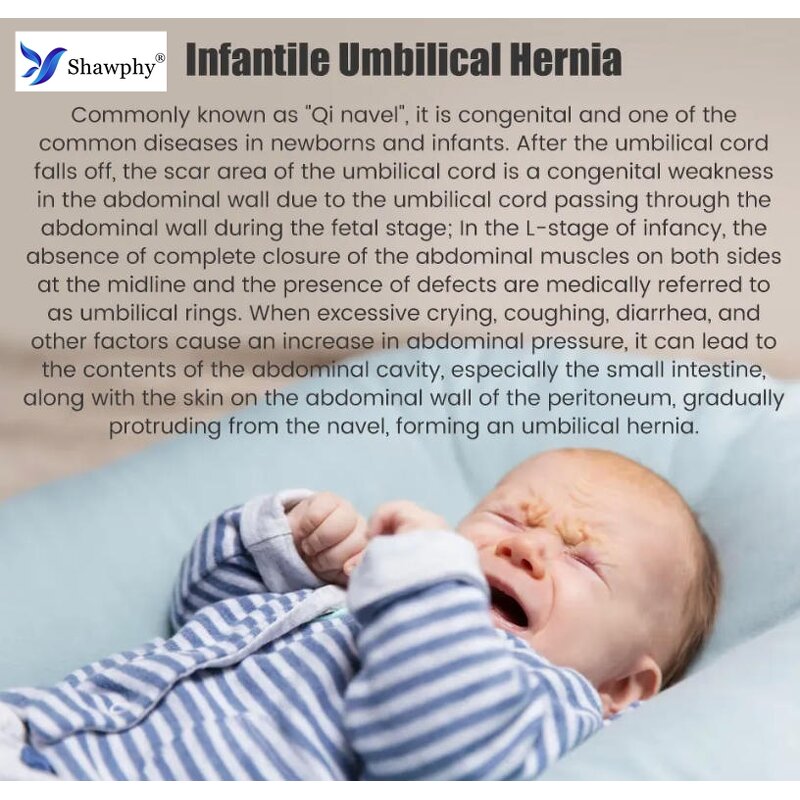 Newborn Hernia Belt Factory - OEM Infant Inguinal Umbilical Belt