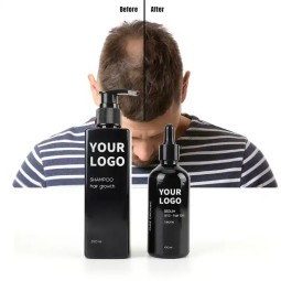 Hair Growth Oil Serum Supplier - Bulk Oil Control Natural Regrowth Treatment